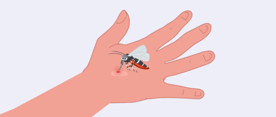 Cover image for West Nile Virus: Symptoms, Treatment & Prevention