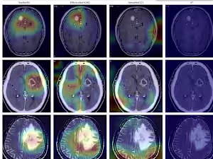 "Beyond the Scan: Enhancing Brain