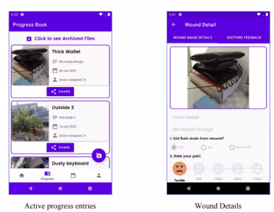 Remote Wound Monitoring System