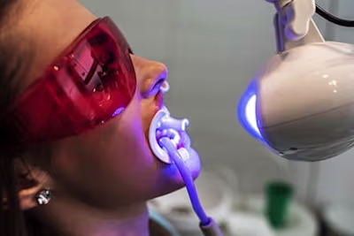 Teeth Whitening vs. Dental Veneers