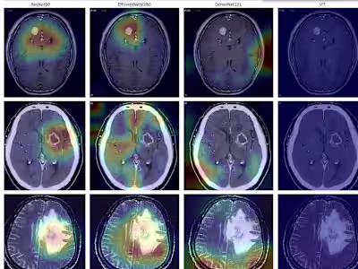 "Beyond the Scan: Enhancing Brain