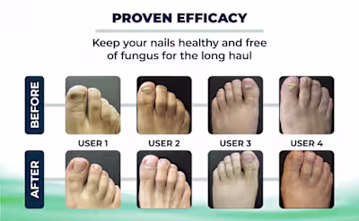 Kerassentials Side Effects: Is It Safe for Daily Use?