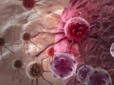 Major types of Cancer, Symptoms and Prevention 