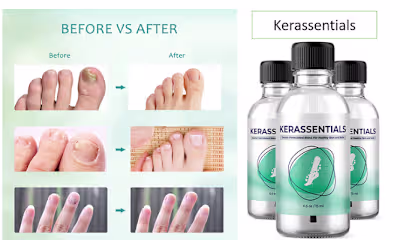 Kerassentials "Genius" (ALERT!) Is it Safe?