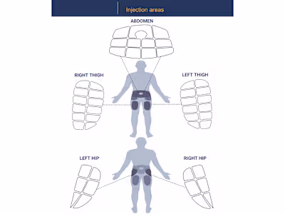 An illustration of injection areas