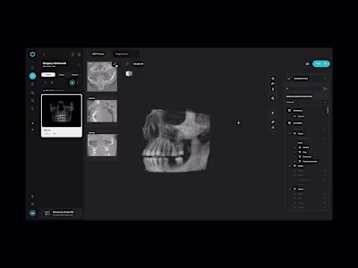 AI pathology detection SaaS / Health Tech
