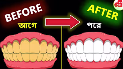 Make Yellow Teeth Sparkle Pearly White at Home (Easy)