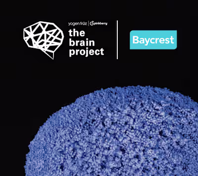 Baycrest x Yogen Früz Pinkberry Brain Project Website Revamp