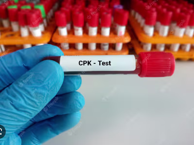 What Is the CPK Enzyme Test?