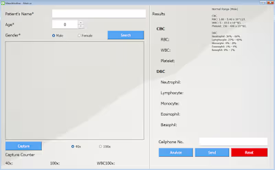 CBC And DBC Counter Using Image Processing