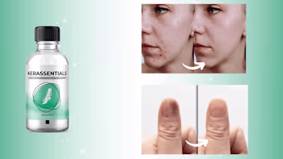 Kerassentials : Scam or Legit in 2026?