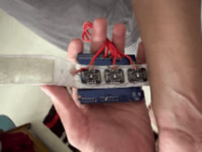 Arteriovenous Hand Fistula Detector