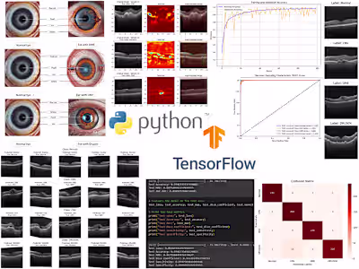 Explainable DL Models for Automated Ophthalmic Diagnosis 