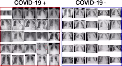 AI-Powered COVID-19 Detection via Chest X-Rays