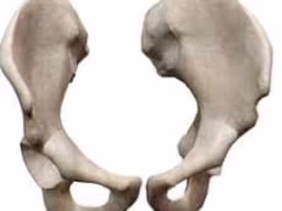 BONES - MosiPhysio