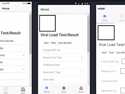 Viral load test for HIV patients