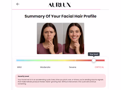 Conversion-Optimized Heyflow for AURLUX Skincare