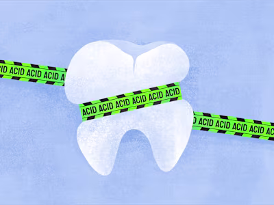 Dental illustrations
