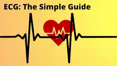 What is an ECG: The Simple Guide