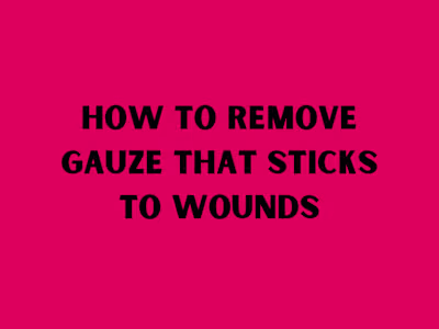 How to Remove Gauze That Sticks to Wounds