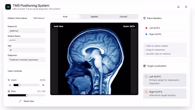Healthcare Content Strategy & UX Transforming mental health ...