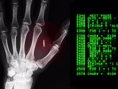 Microchipping Employees is a No-good, Horrible and Terrible Idea