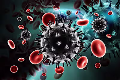 HIV and Increased Risk for Heart Attack