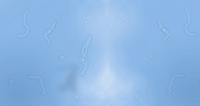 What are those transparent things floating in our vision?