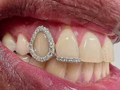 3D Design Trends in Modern Jewelry