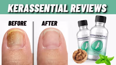 Kerassentials (Trick or Genuine) - Is It Great!