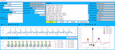 Real-Time Detection and Classification of Heart Arrhythmia