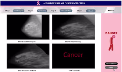 Breast Cancer Detection Application