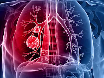 samrat0033/Lung_Cancer_Prediction