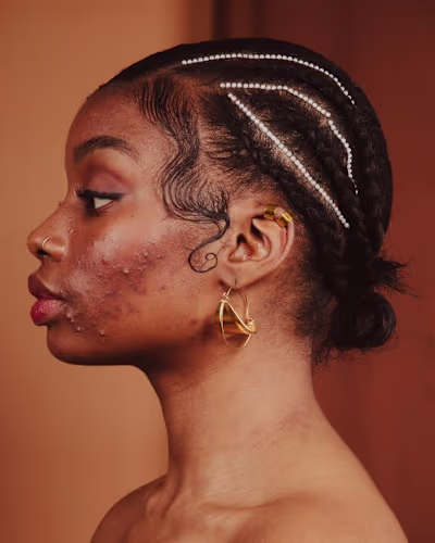 Skin retouching & Blemish removal
