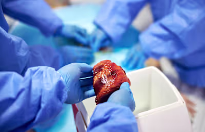 How Xenotransplantation Moved To Lifesaving Reality