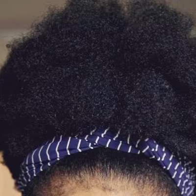 Chidalu on Instagram: “Still on the journey back to what my ski…