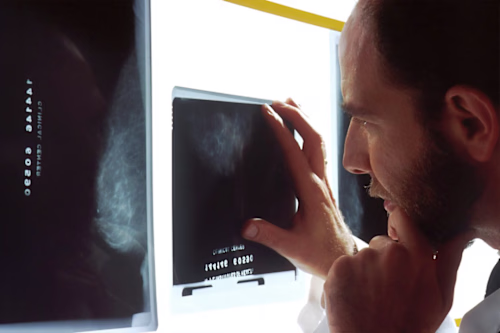 How AI is Revolutionizing Oncology Care at Your Practice
