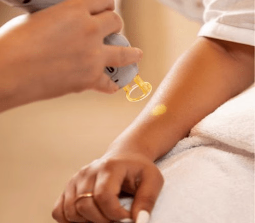 IPL and Laser Hair Removal: Which one’s the winner?