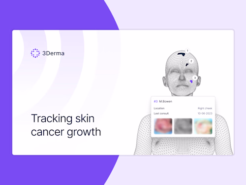 Analyze skin lesions to help detect early signs of skin cancer
