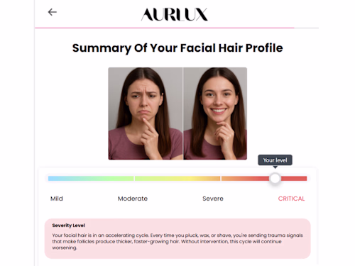 Conversion-Optimized Heyflow for AURLUX Skincare