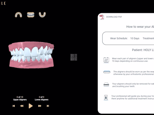 3D Viewer for dental clinics