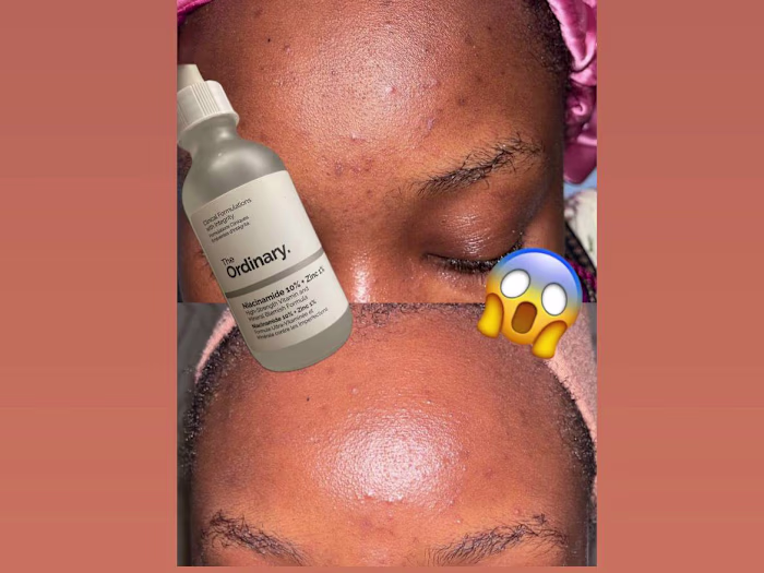 OMG! The Best SERUM Ever!