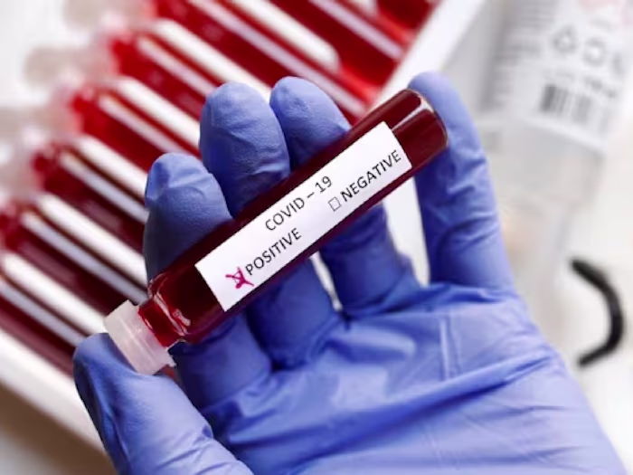 The Pandemic's Impact: Transforming Our Lives and Shaping a New 