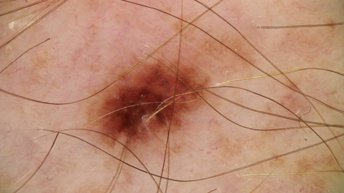 Optimal Image Preprocessing using OpenCL