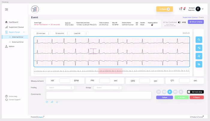 AI-Powered ECG Analysis Platform