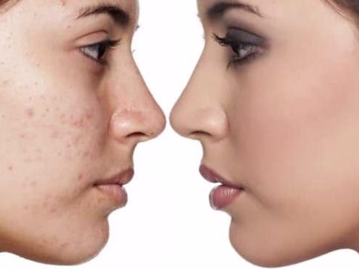 Como o Yenki Derm funciona?