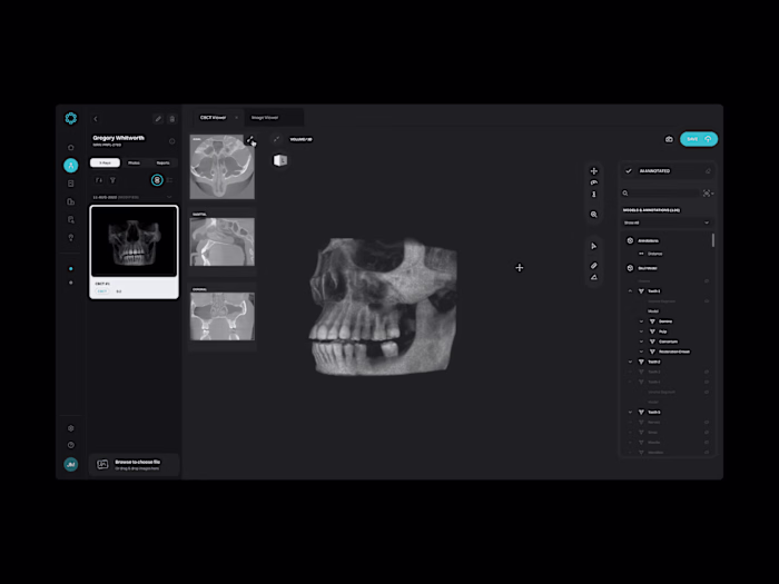 AI pathology detection SaaS / Health Tech