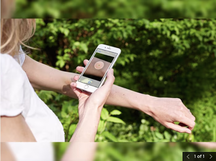 AI Skin Cancer Detection Application