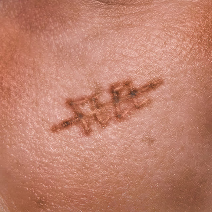 "Cicatrici d'autore" song cover 