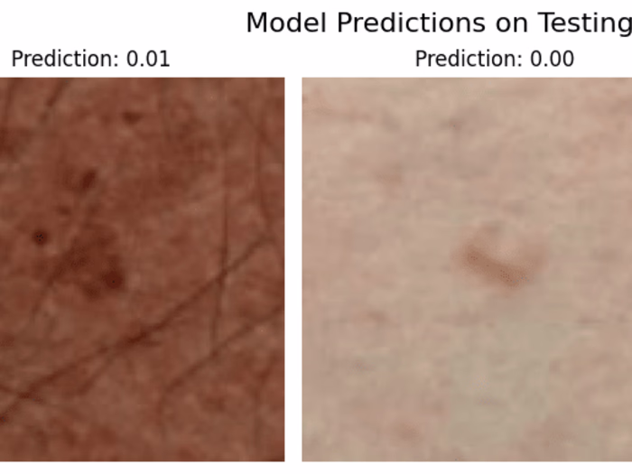 Skin Lesion Detection Using Convolutional Neural Networks – ISI…